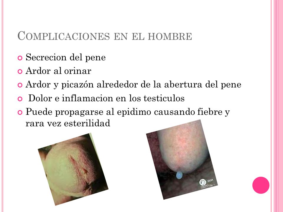 El aumento del miembro viril público por el modo